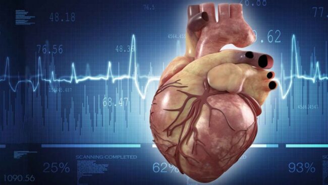 endocardite-imagem2-1200×677