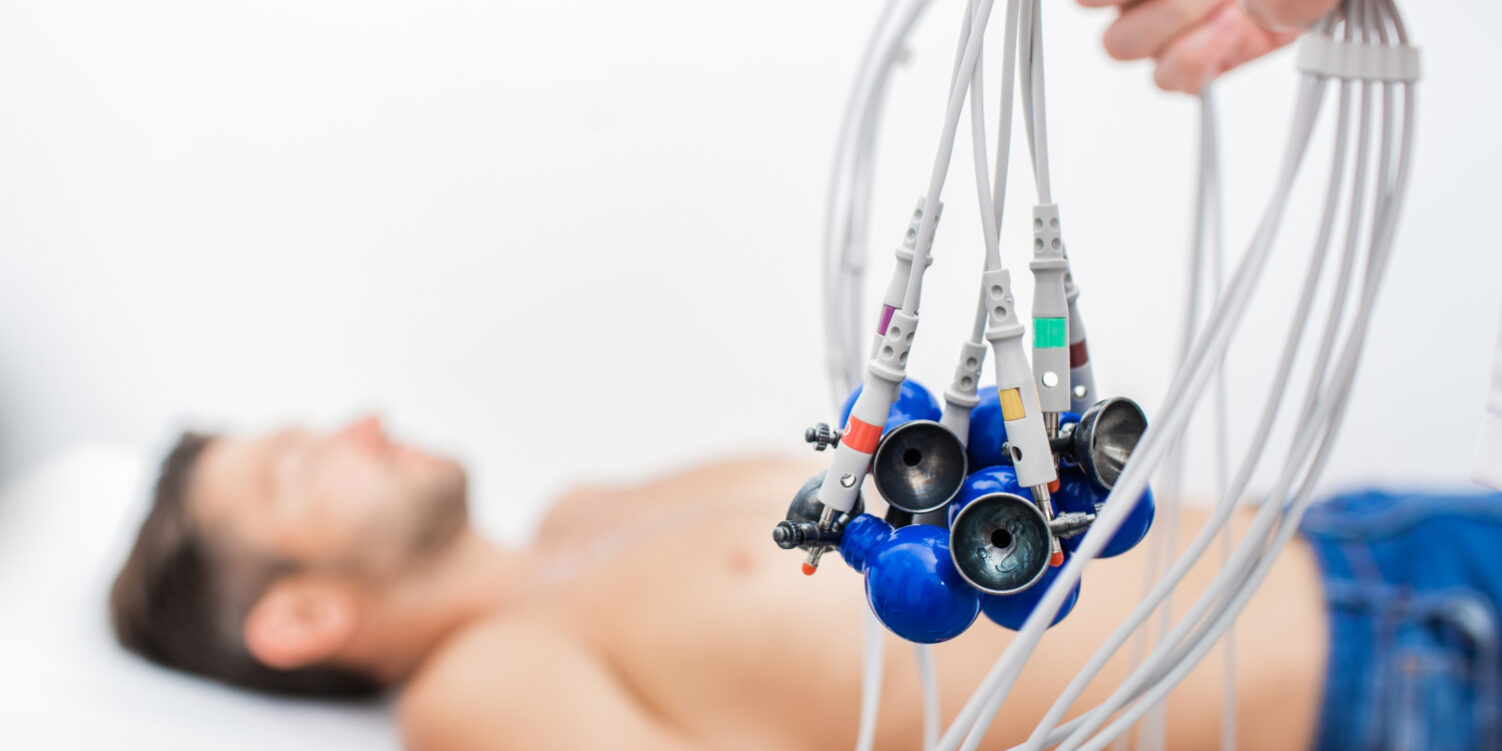 shutterstock_ecg_eletrocardiograma A Importância Vital do Exame de Eletrocardiograma na Saúde Cardíaca